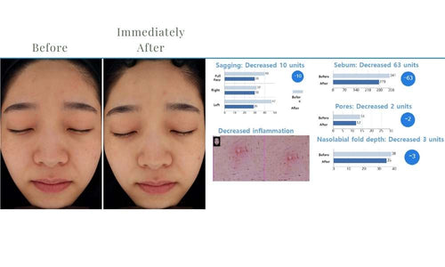 Load image 1 in gallery view. ACE Hydra-dermabrasion Facial