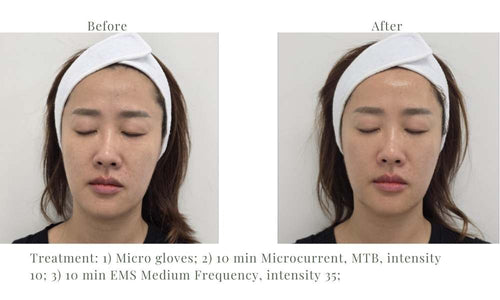 Load image 1 in gallery view. ACE Hydra-dermabrasion Facial