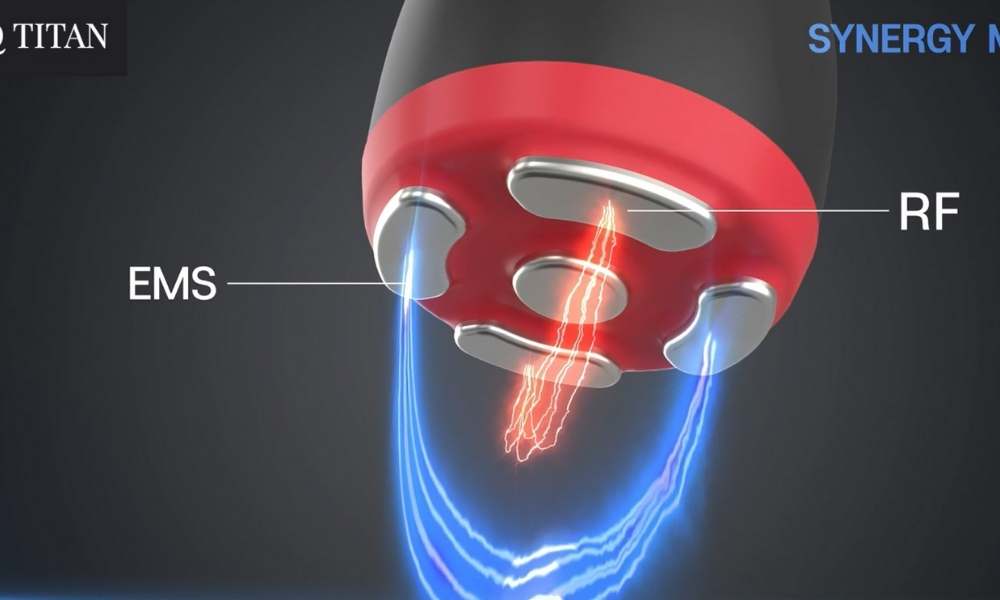 TITAN Facial RF