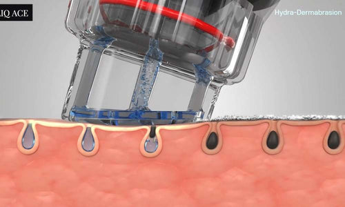 Load image 1 in gallery view. ACE Hydra-dermabrasion Facial