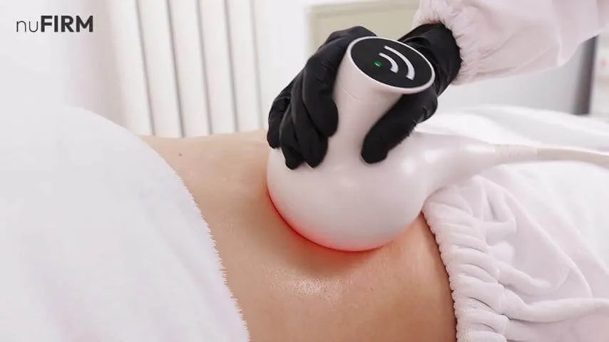nuFIRM - RF Fascia - Remodeling Body Contouring System