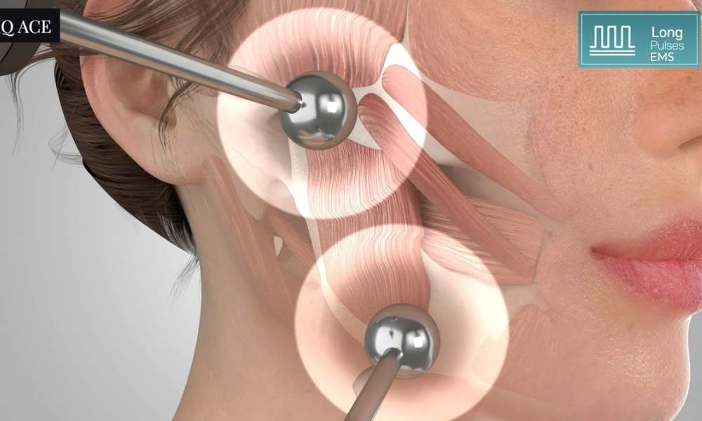 ACE Hydra-dermabrasion Facial