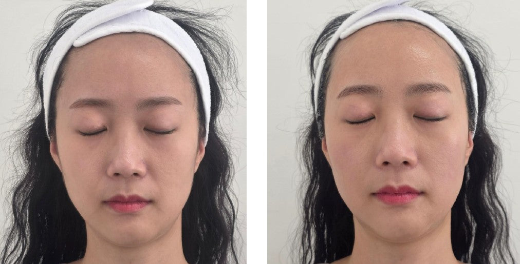 Before and after treatment results