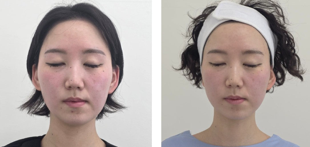 Before and after treatment results