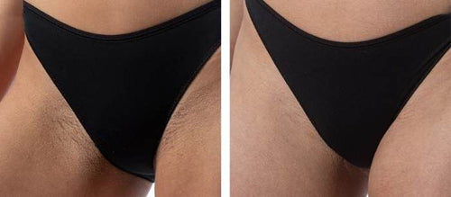 Load image 1 in gallery view. nuSILK - AI- Powered Diode Laser Hair Removal Platform
