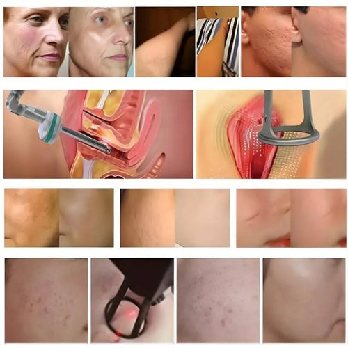 Load image 1 in gallery view. nuCO2 FX - fractional CO2 resurfacing