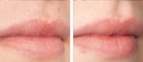 Load image 1 in gallery view. nuSILK - AI- Powered Diode Laser Hair Removal Platform