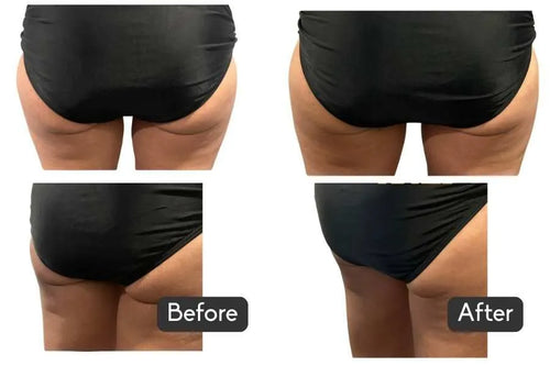 Load image 1 in gallery view. nuFORM- Advanced Muscle & Longevity EMS Platform