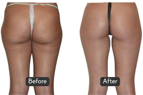 Load image 1 in gallery view. nuFORM- Advanced Muscle & Longevity EMS Platform