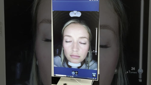 Load image 1 in gallery view. nuNAV - 3D Facial Image Analysis