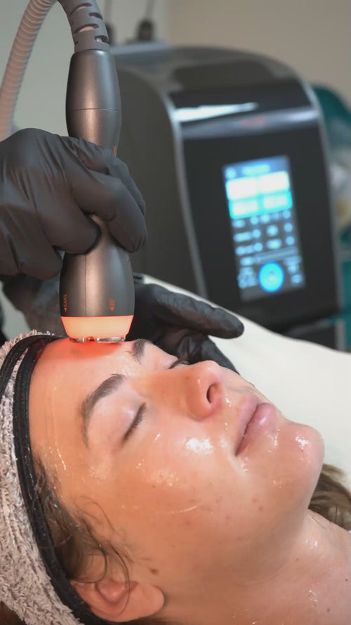 Load image 1 in gallery view. TITAN Facial RF