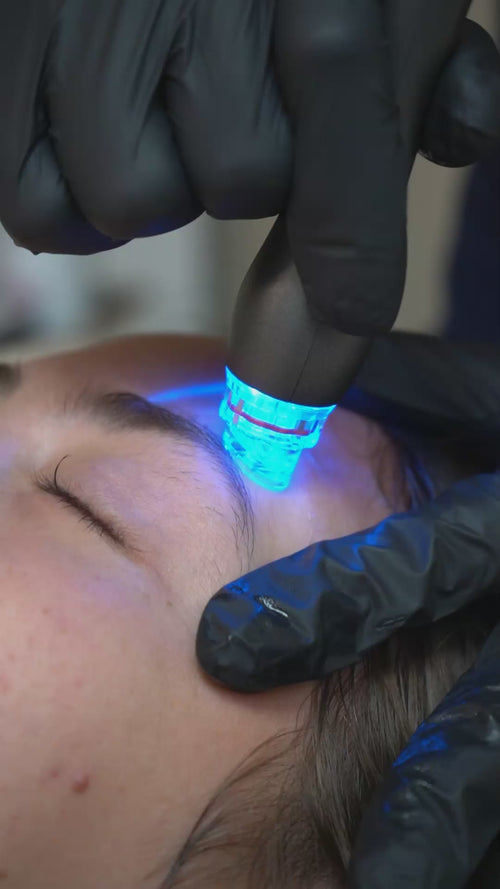 Load image 1 in gallery view. ACE Hydra-dermabrasion Facial